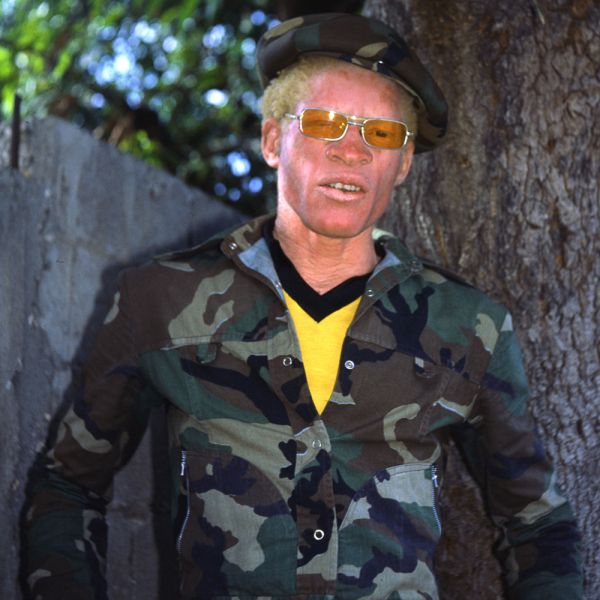 Archivo:Yellowman.jpg